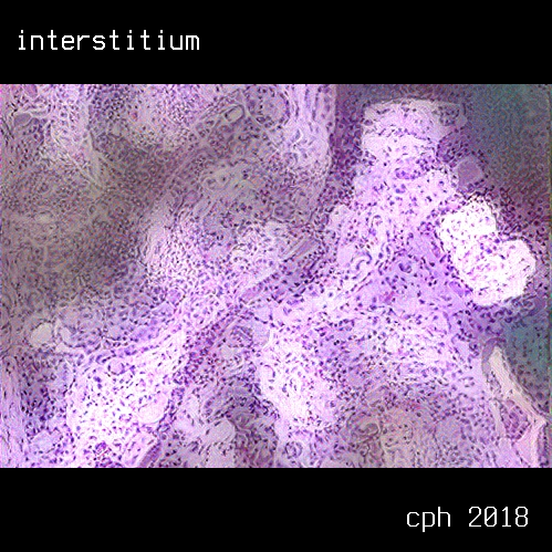 Is the Interstitium Really a New Organ?